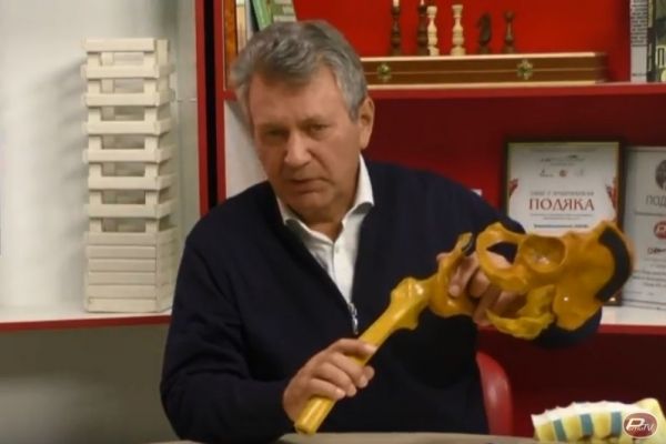 Професор з Німеччини консультував рівненських лікарів та розповів про протезування (Відео)