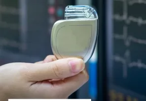 В Україні безкоштовно встановлюють кардіостимулятори: в яких закладах їх імплантують на Рівненщині
