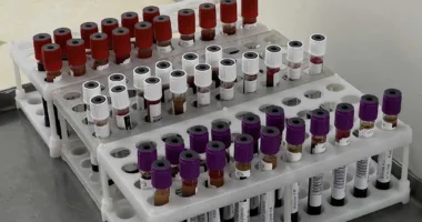 У Рівному продовжують закликати всіх долучитися до здачі крові