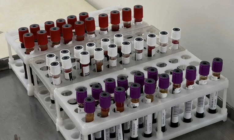 У Рівному продовжують закликати всіх долучитися до здачі крові