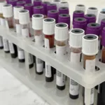 Бракує першої та другої груп: у Рівному продовжують шукати донорів крові